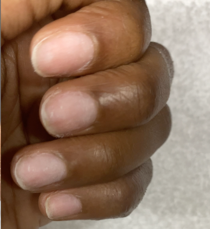 Ongle Guadeloupe - Nail art - Roseacoranails